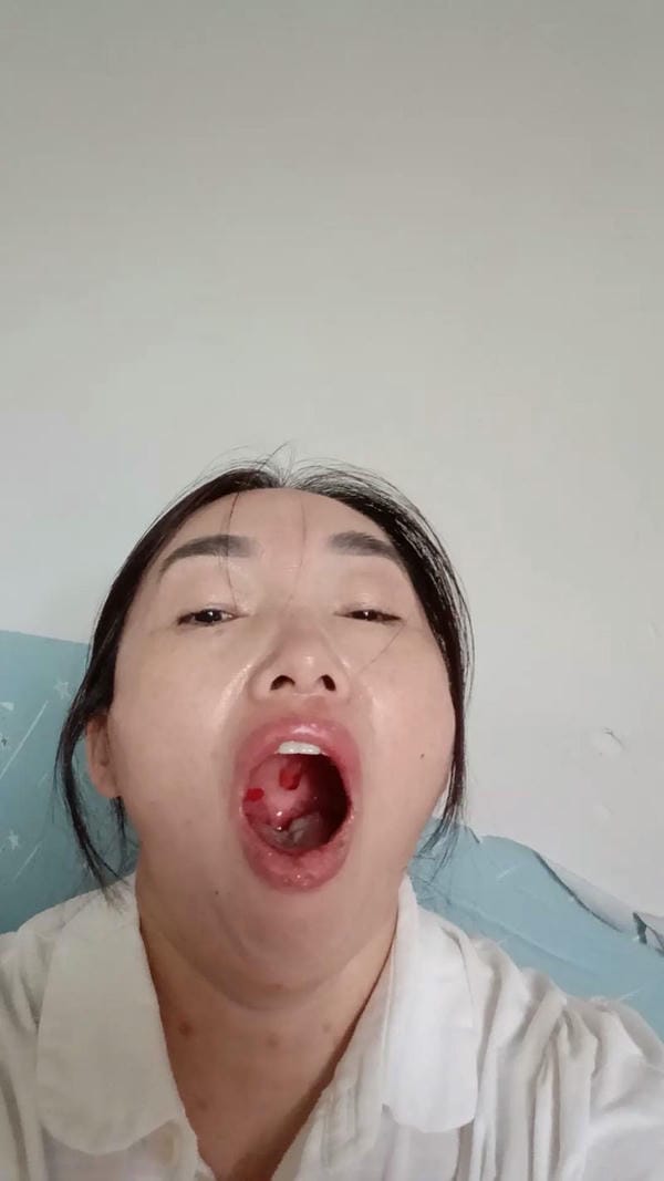 hình ảnh nốt chân tay miệng 24