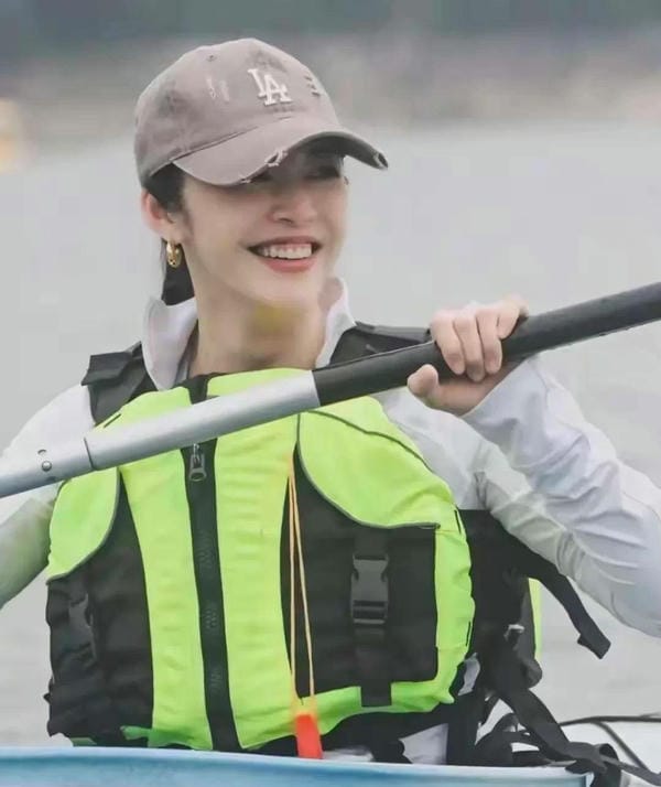 hình ảnh răng hô nhẹ 17