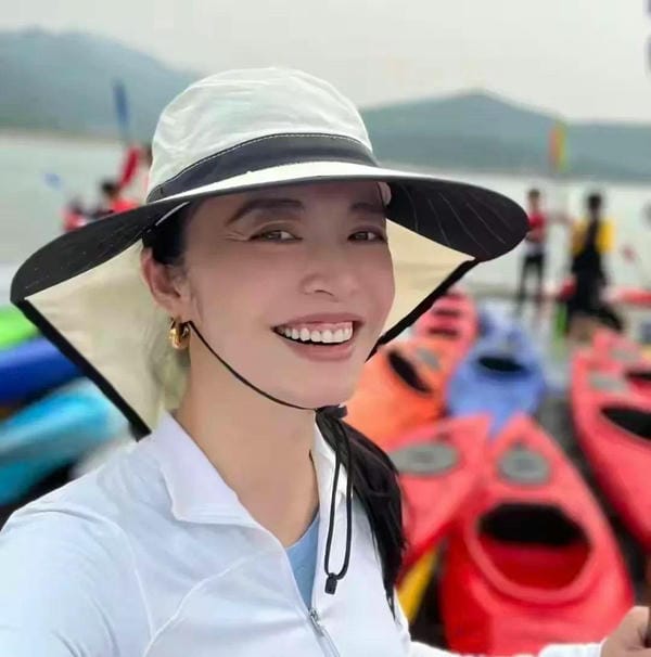 hình ảnh răng hô nhẹ 18