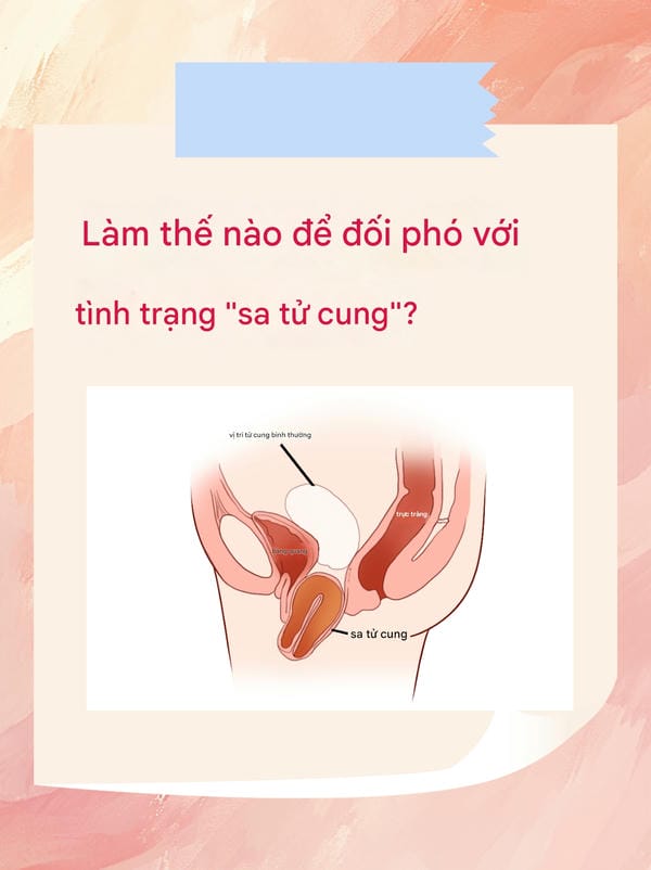 hình ảnh sa tử cung độ 1 11