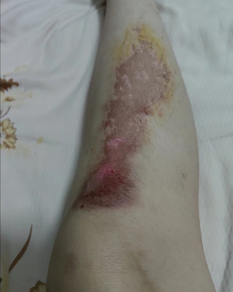 Ảnh xin ngỉ làm 35