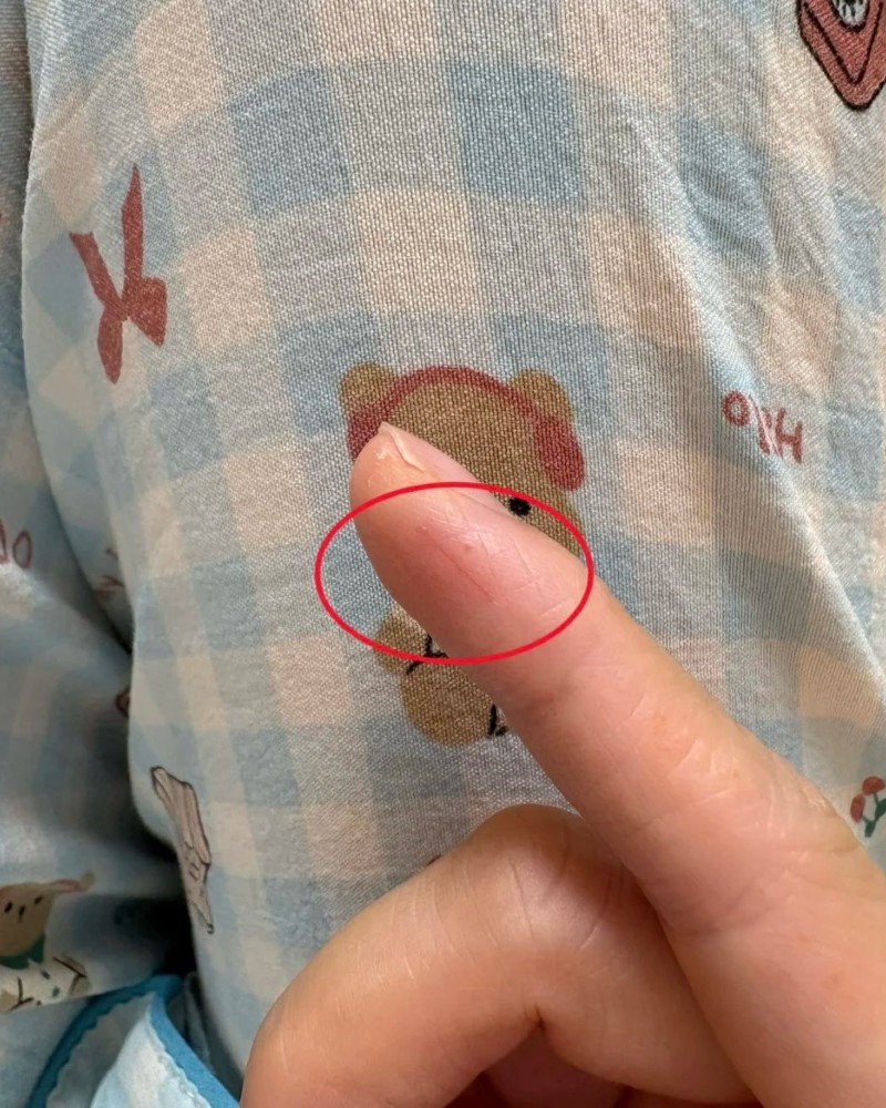 ảnh bị đứt tay 19