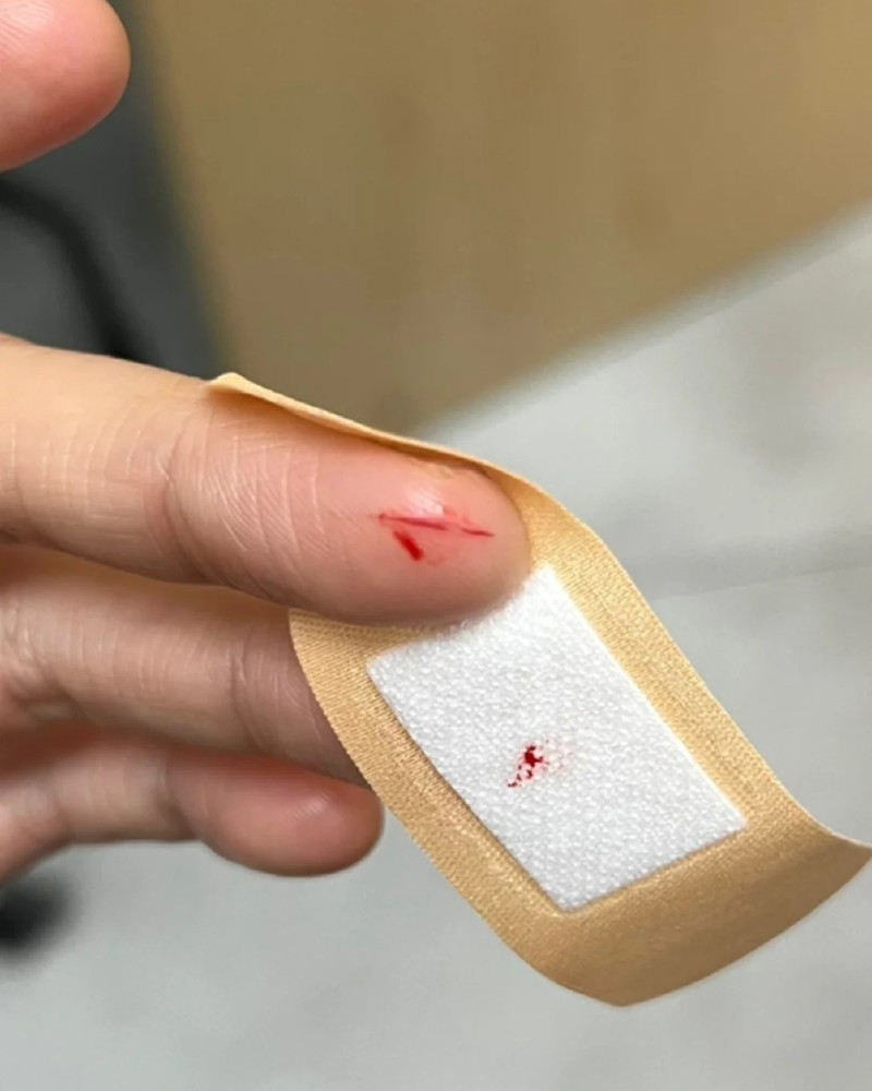 ảnh bị đứt tay 32