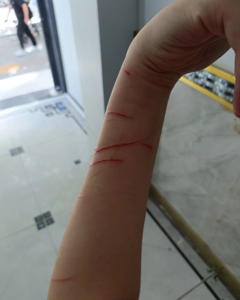 ảnh cắt tay 21