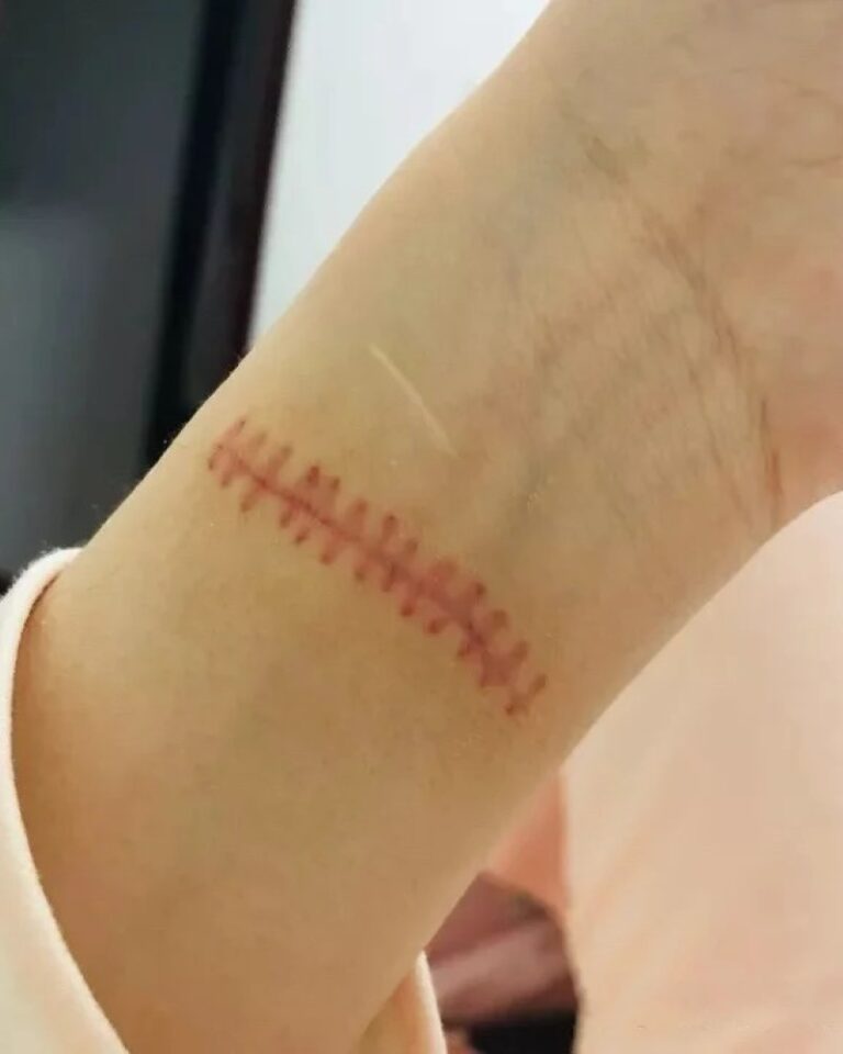 Tổng hợp 99+ ảnh cắt tay mang chiều sâu cảm xúc, gây suy ngẫm Tổng hợp 99+ ảnh cắt tay mang chiều sâu cảm xúc, gây suy ngẫm
