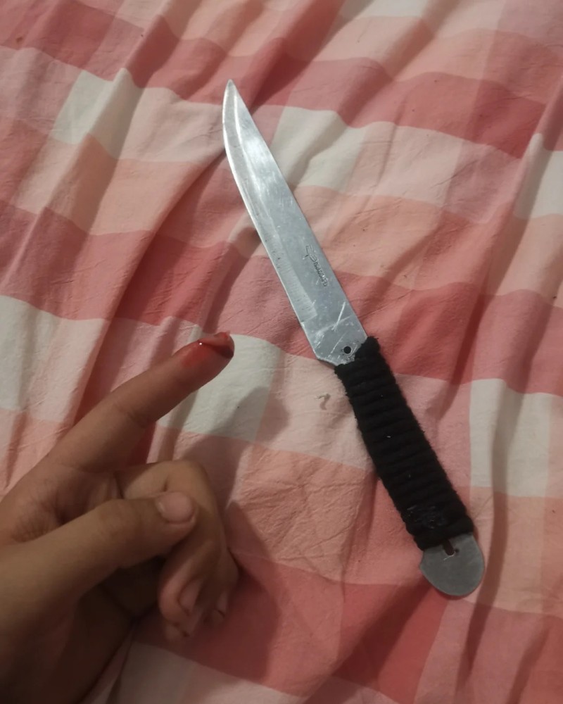 ảnh cắt tay 5