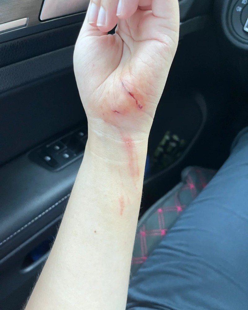 ảnh cắt tay đẹp