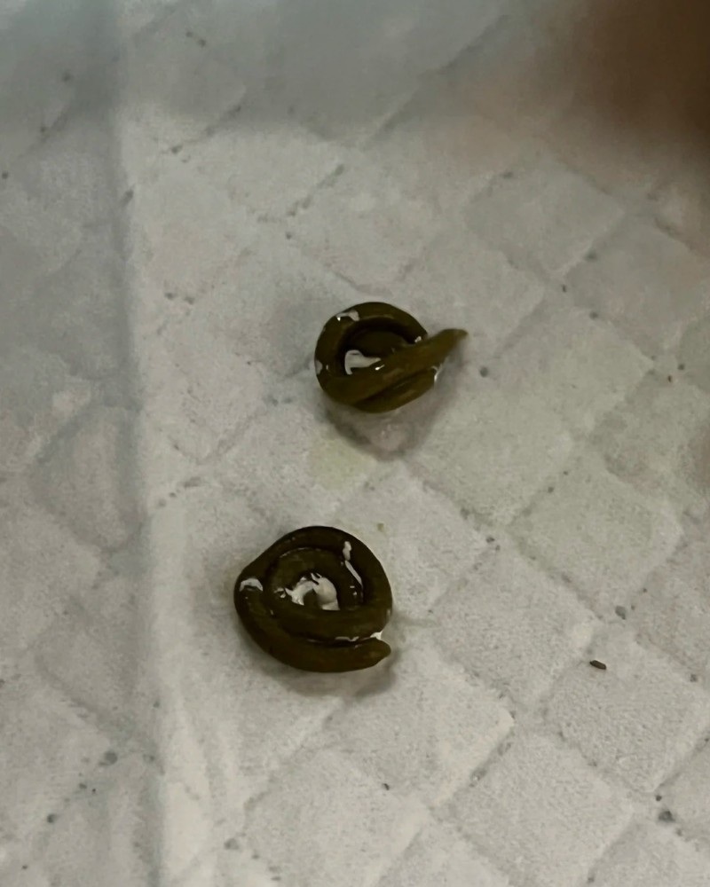 ảnh cục cứt 14