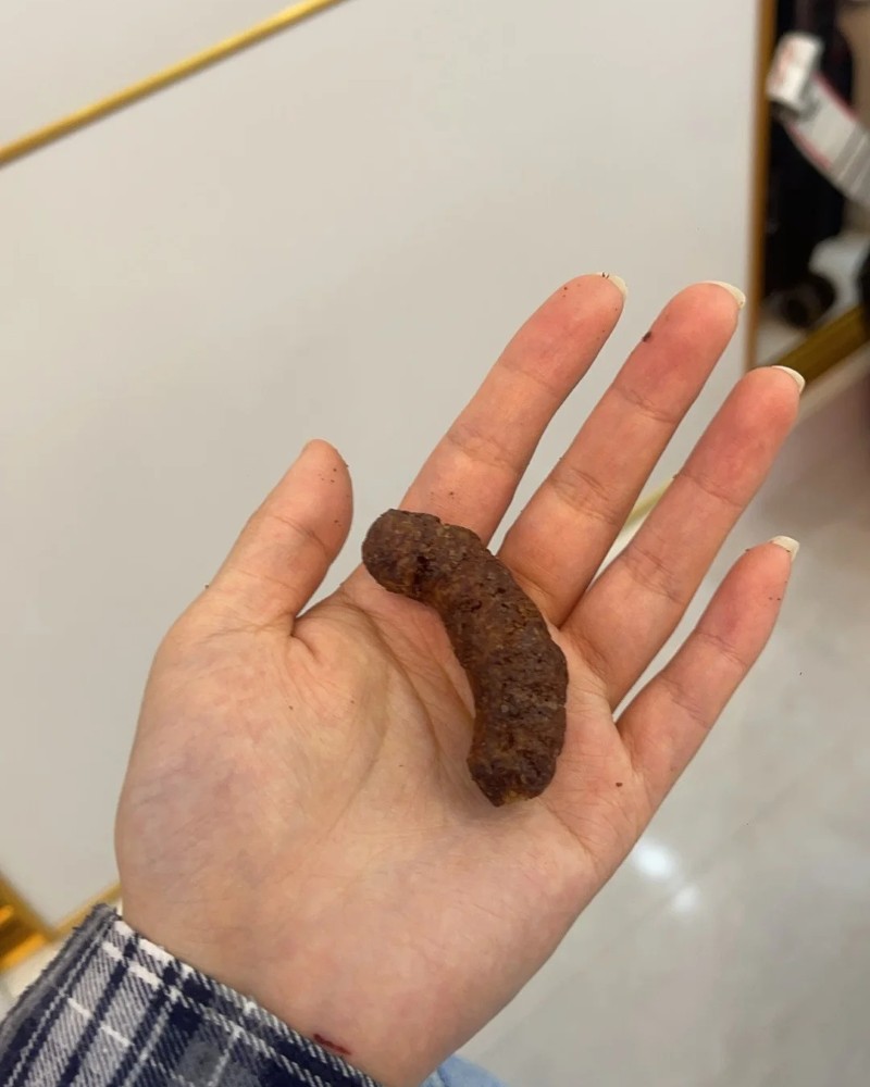 ảnh cục cứt 20