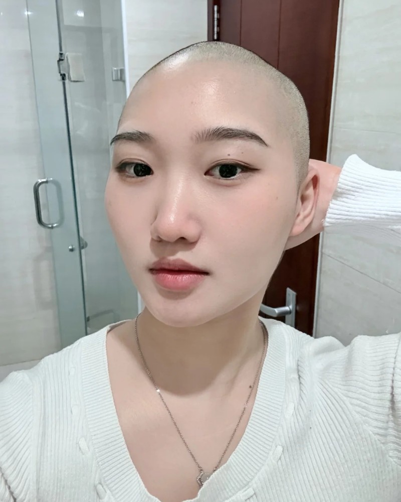 ảnh đầu trọc 1