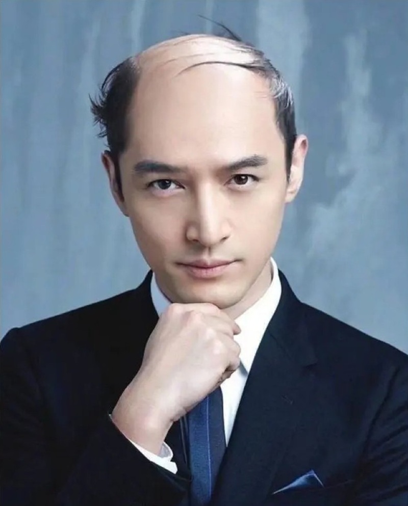 ảnh đầu trọc 12