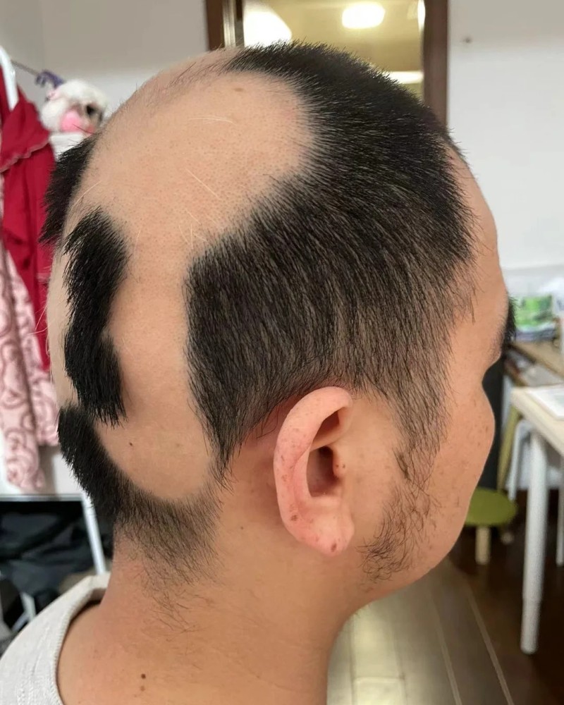ảnh đầu trọc 15