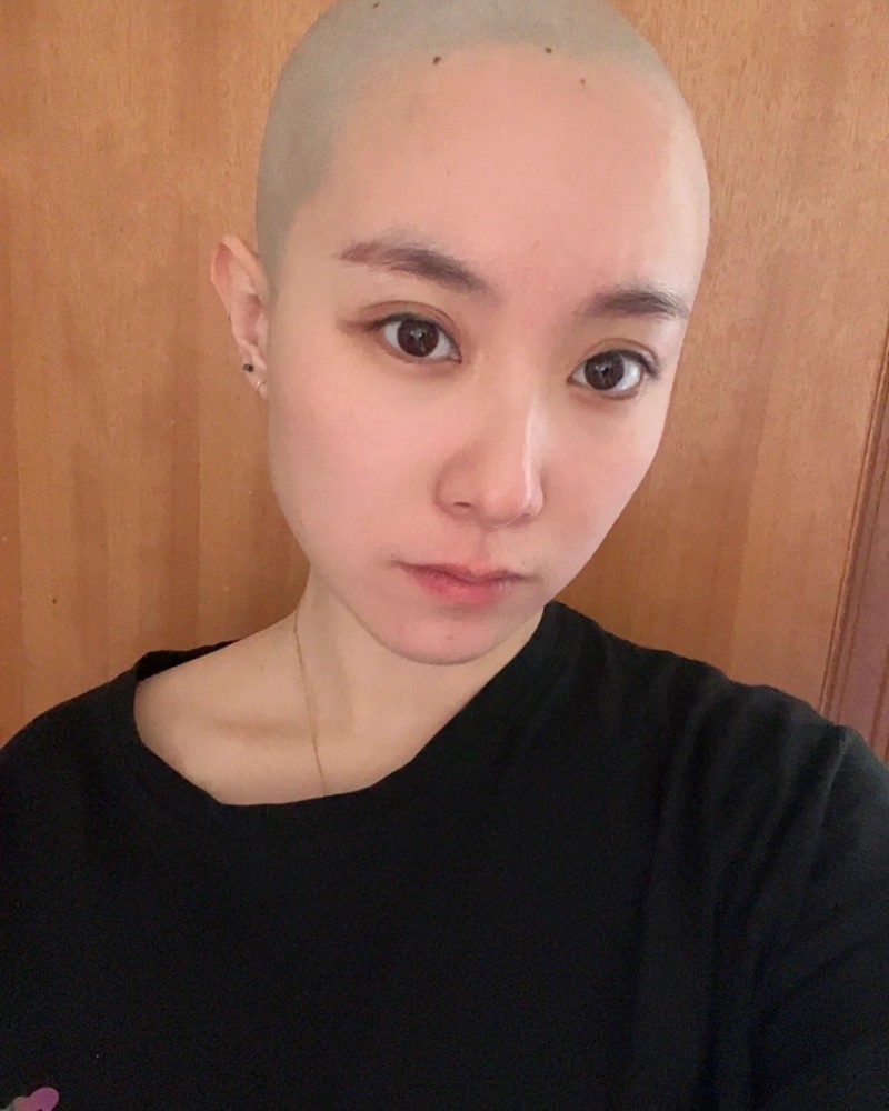 ảnh đầu trọc 18