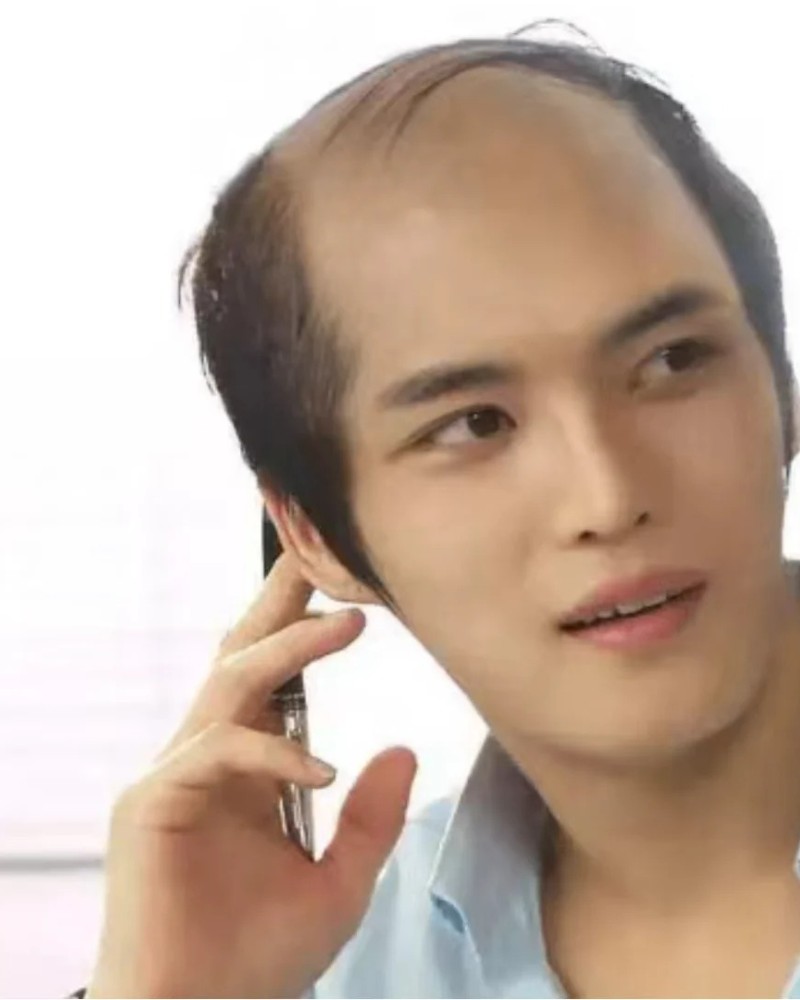 ảnh đầu trọc 24