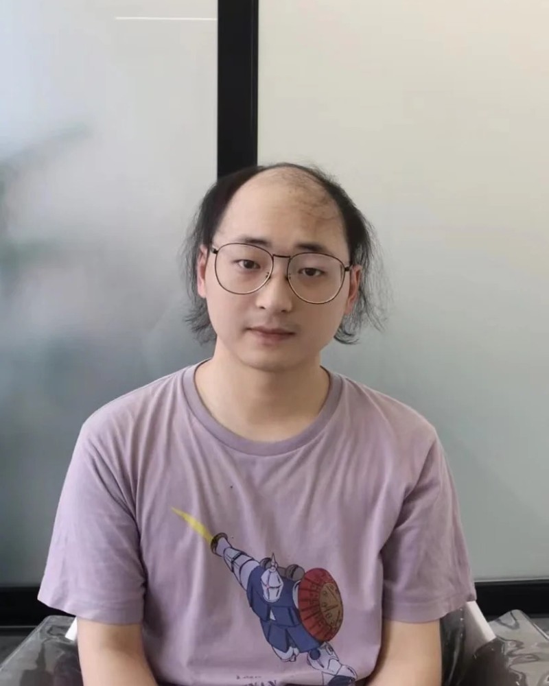 ảnh đầu trọc 25