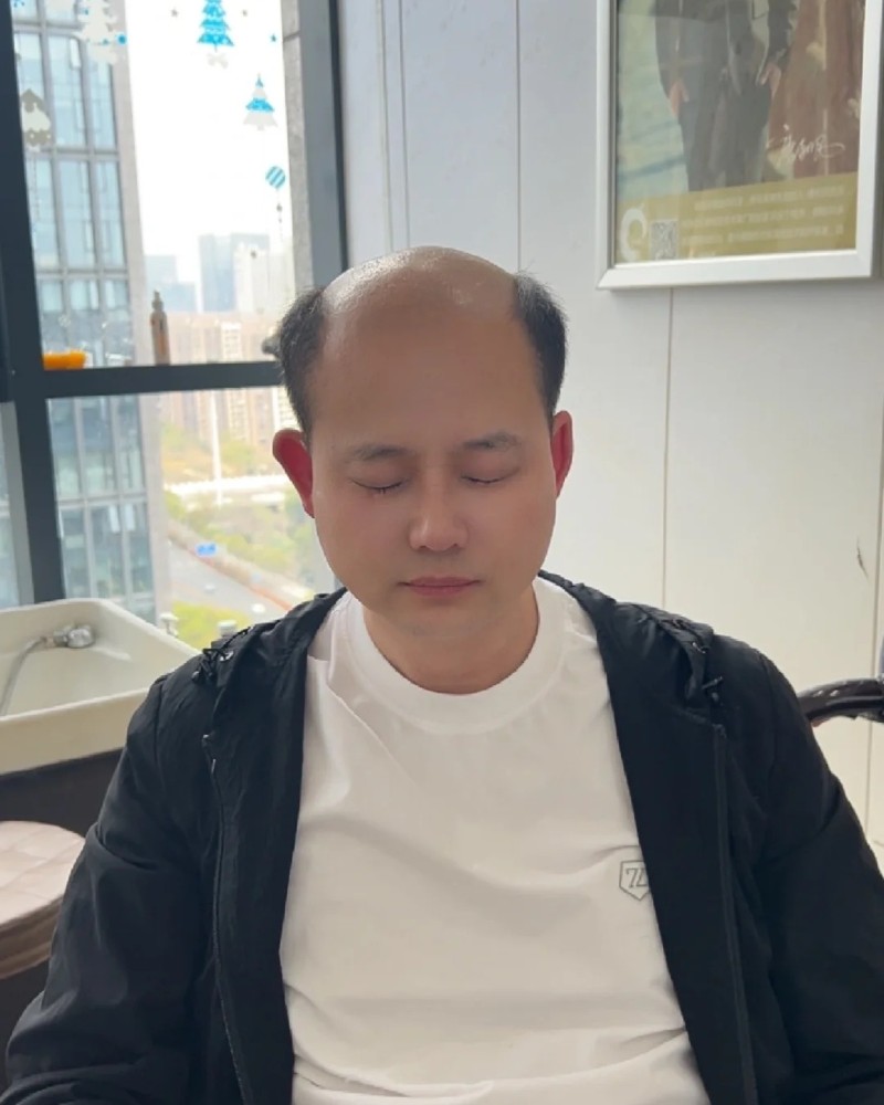 ảnh đầu trọc 27