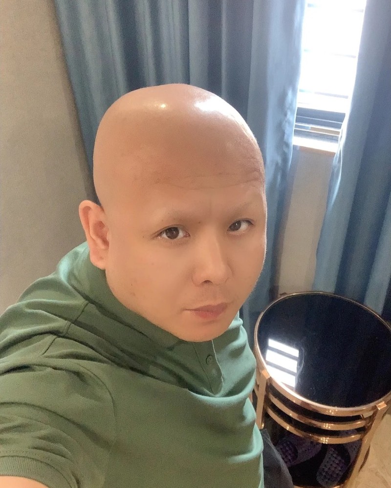 ảnh đầu trọc 29