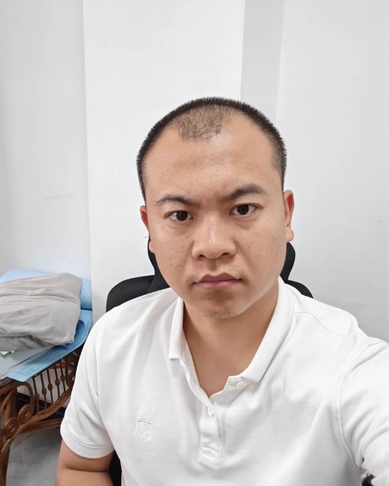 ảnh đầu trọc 3
