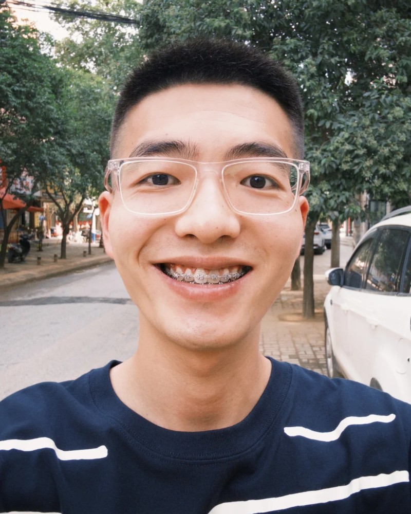 ảnh đầu trọc 32