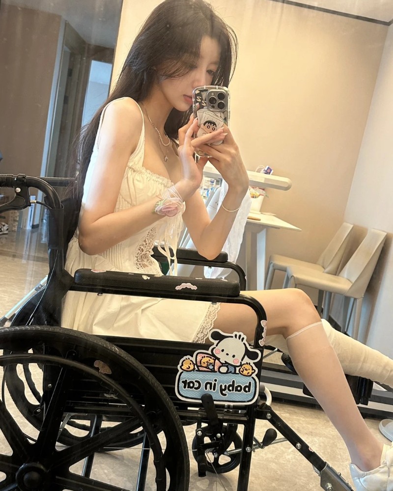 ảnh gãy chân 25