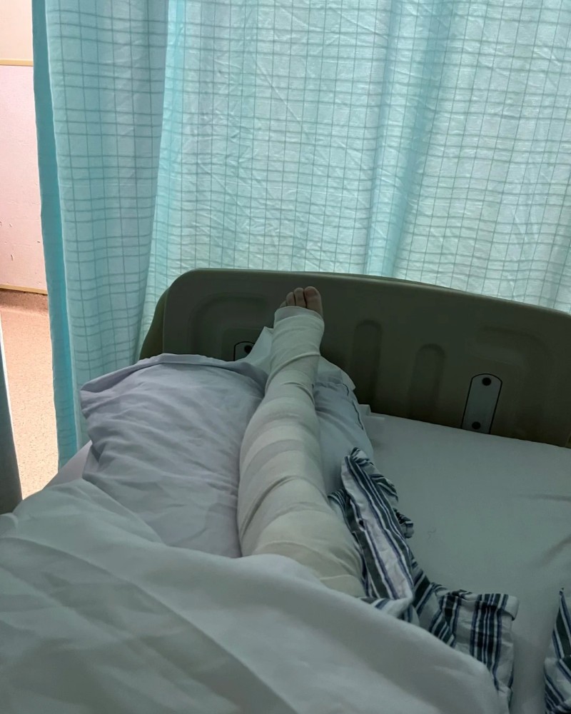 ảnh gãy chân 30