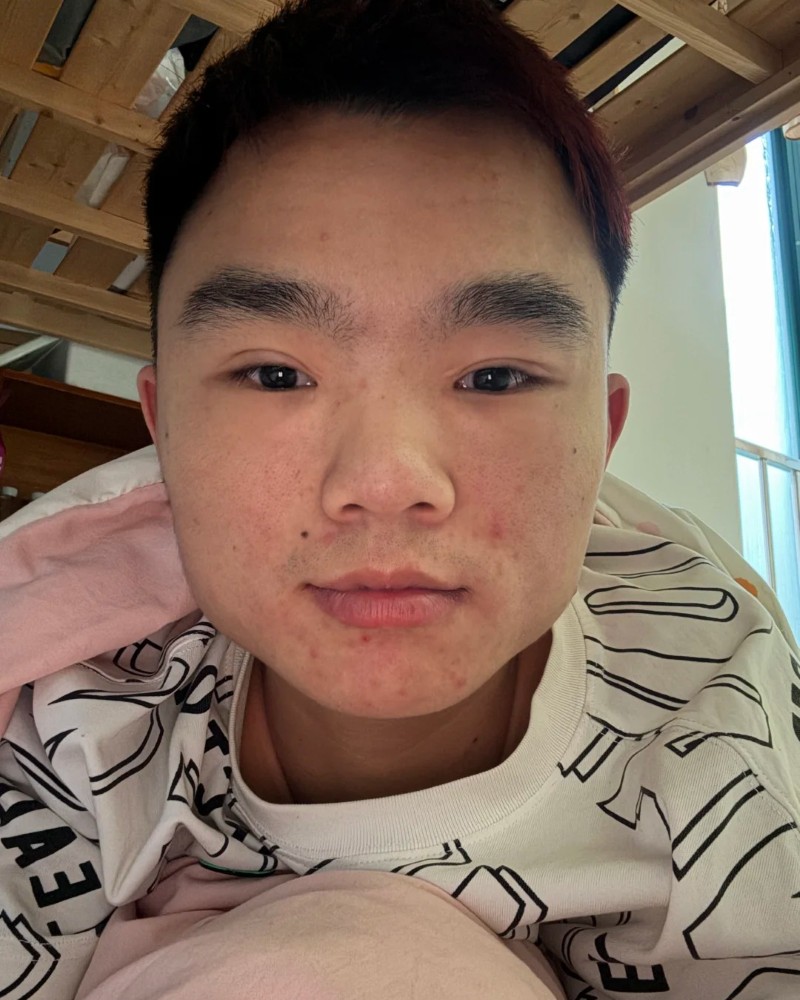 ảnh trai xấu 1