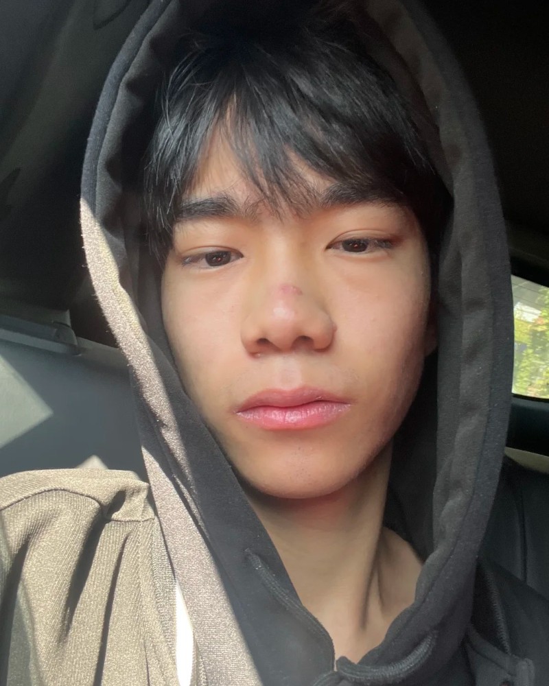 ảnh trai xấu 27