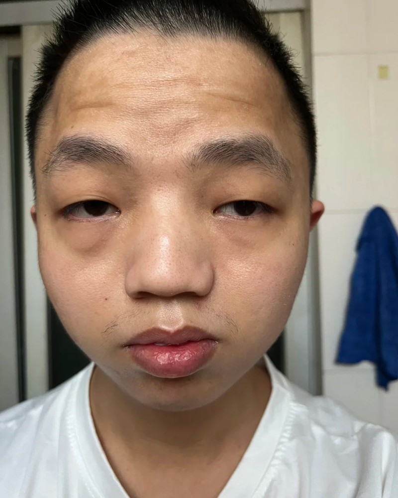 ảnh trai xấu 36