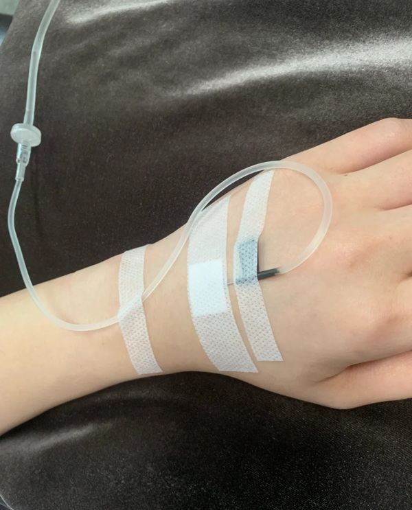 ảnh truyền nước biển 36