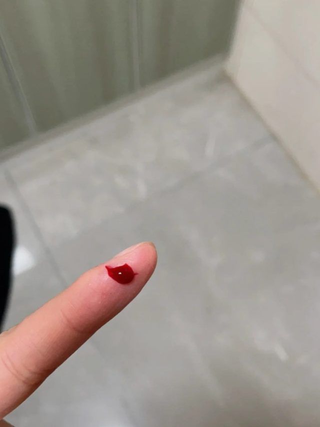 ảnh bị đứt tay 12