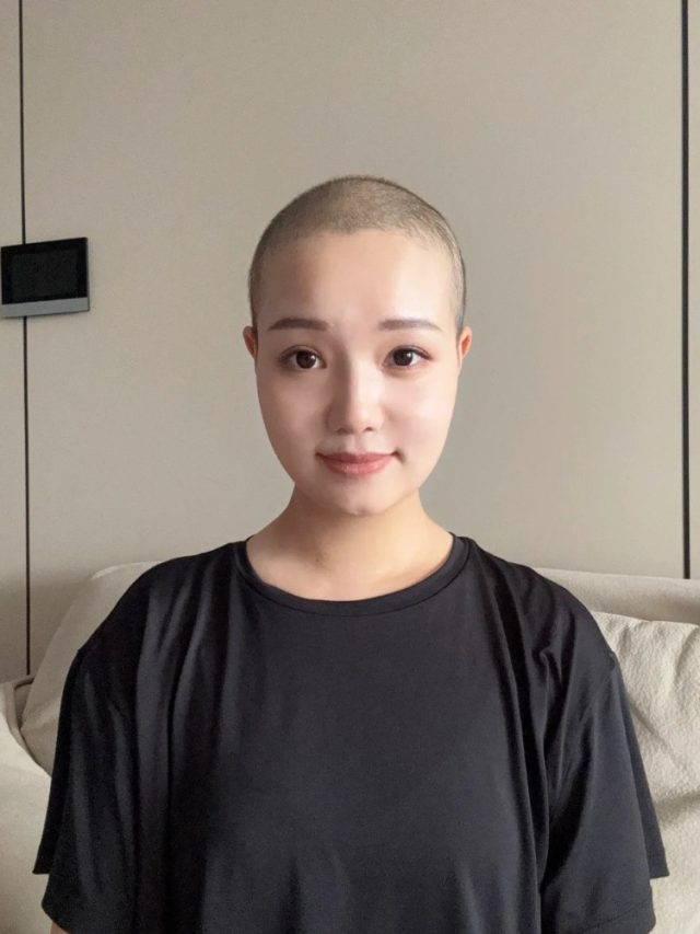 ảnh đầu trọc 23
