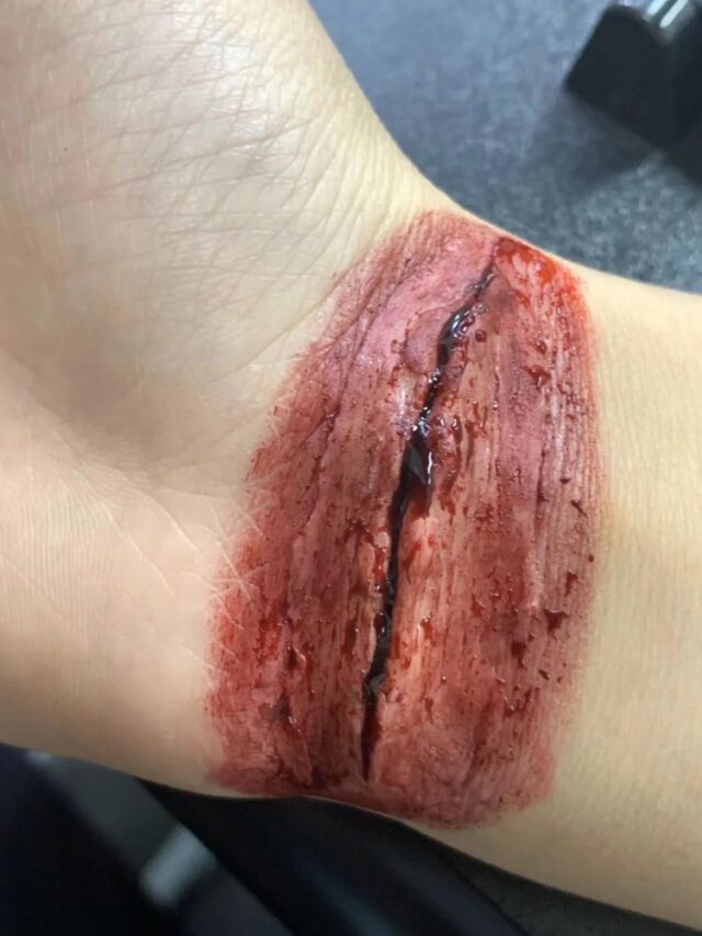 hình ảnh cắt cổ tay