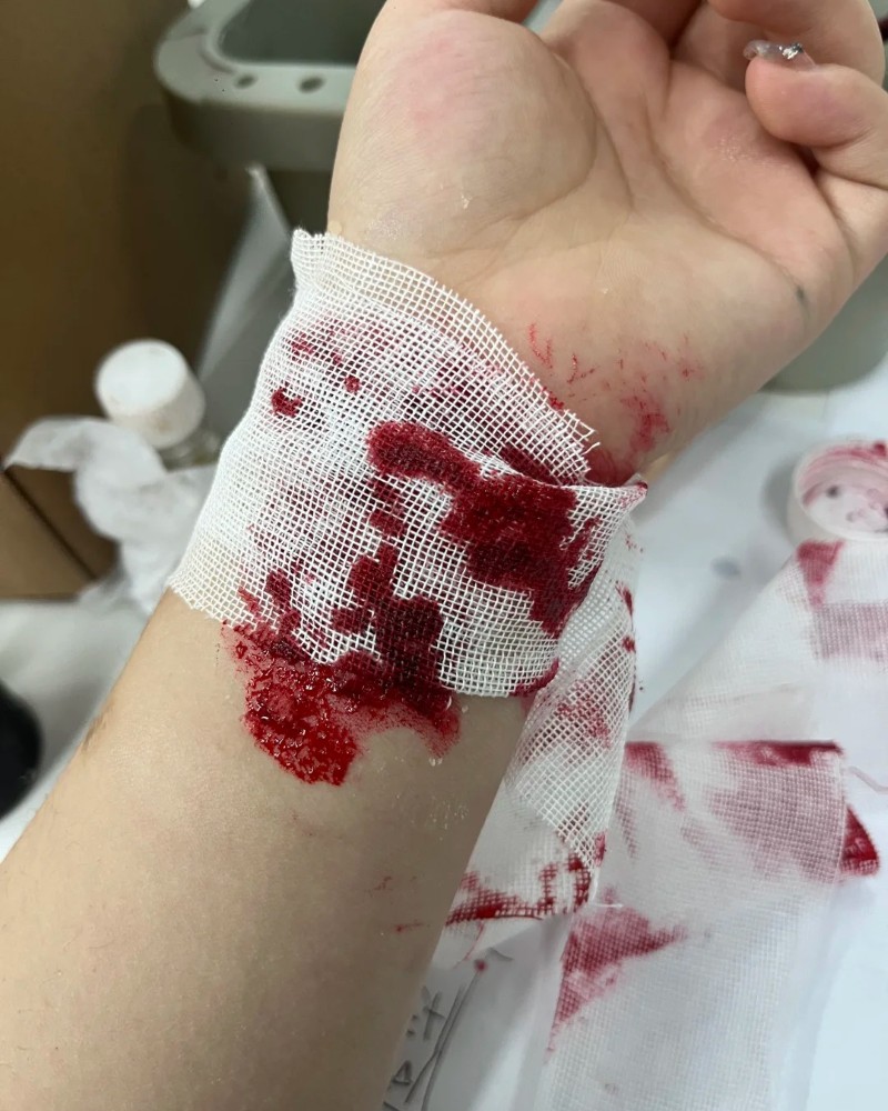 hình ảnh cắt tay tự sát