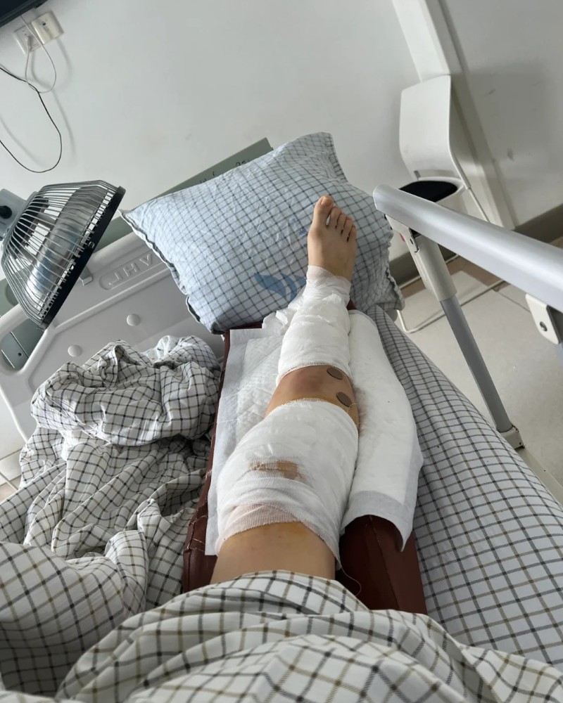 hình ảnh gãy chân nằm viện