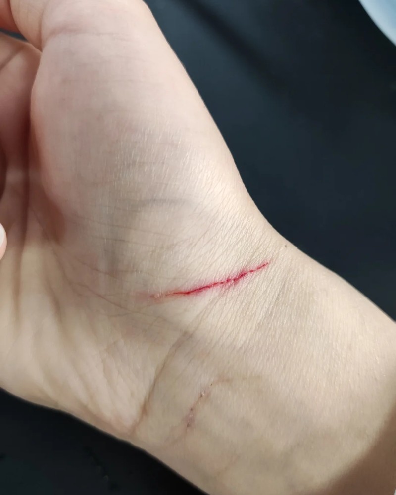 tải ảnh cắt tay